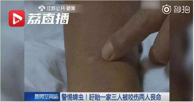 中山市民注意蜱蟲叮咬！請做好這些預防措施